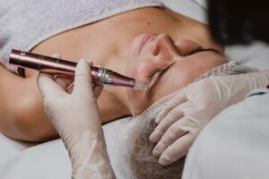 Fibroblast Plasma vs Microneedling